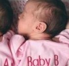 1～40周胎儿双顶径标准数值表，在不在正常范围看完便知